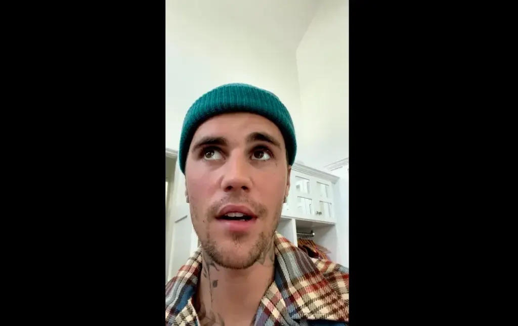 Justin Bieber e síndrome de Ramsay Hunt.